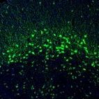 Immunofluorescence staining of mouse superior colliculi shows positivity in a subset of neurons.