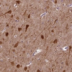 Immunohistochemical staining of human cerebral cortex shows strong cytoplasmic positivity in neurons.