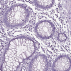 Anti-NECAB1 Antibody