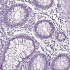 Immunohistochemical staining of human colon shows no positivity in glandular cells as expected.
