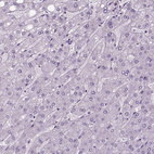 Immunohistochemical staining of human liver shows no positivity in hepatocytes as expected.