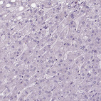 Anti-NECAB1 Antibody