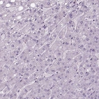 Immunohistochemical staining of human liver shows no positivity in hepatocytes as expected.