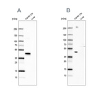 Western blot analysis using Anti-NECAB1 antibody HPA023629 (A) shows similar pattern to independent antibody HPA025963 (B).