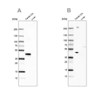 Western blot analysis using Anti-NECAB1 antibody HPA023629 (A) shows similar pattern to independent antibody HPA025963 (B).