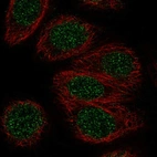 Immunofluorescent staining of human cell line MCF7 shows localization to nucleoplasm.