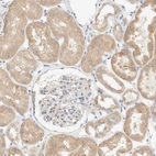 Immunohistochemical staining of human kidney shows moderate cytoplasmic positivity in cells in tubules.