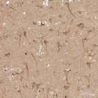 Immunohistochemical staining of human cerebral cortex shows moderate cytoplasmic positivity in neuronal cells.
