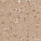 Immunohistochemical staining of human cerebral cortex shows moderate cytoplasmic positivity in neuronal cells.