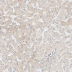 Immunohistochemical staining of human liver shows weak cytoplasmic positivity in hepatocytes as expected.