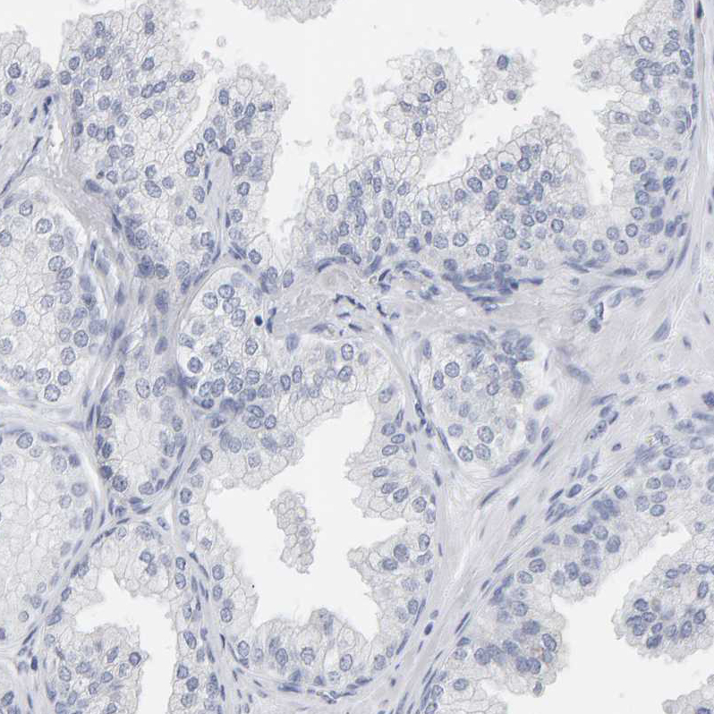 Anti-SPACA3 Antibody