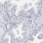 Anti-SPACA3 Antibody
