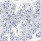 Anti-SPACA3 Antibody