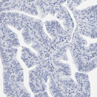 Immunohistochemical staining of human fallopian tube shows no positivity in glandular cells as expected.