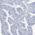 Immunohistochemical staining of human fallopian tube shows no positivity in glandular cells as expected.
