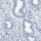 Immunohistochemical staining of human endometrium shows no positivity in glandular cells as expected.