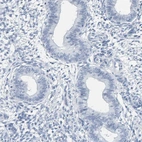 Immunohistochemical staining of human endometrium shows no positivity in glandular cells as expected.