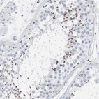 Immunohistochemical staining of human testis shows strong cytoplasmic positivity in spermatids.