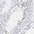Immunohistochemical staining of human testis shows strong cytoplasmic positivity in spermatids.
