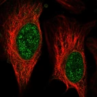 Immunofluorescent staining of human cell line U-2 OS shows localization to nucleoplasm.