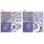 Immunohistochemical staining of human adrenal gland, kidney, lymph node and testis using Anti-STAR antibody HPA023644 (A) shows similar protein distribution across tissues to independent antibody HPA027318 (B).