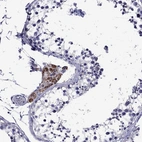 Immunohistochemical staining of human testis shows strong positivity in mitochondria in Leydig cells.