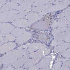 Immunohistochemical staining of human skeletal muscle shows no positivity in myocytes as expected.