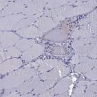 Immunohistochemical staining of human skeletal muscle shows no positivity in myocytes as expected.
