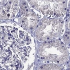Immunohistochemical staining of human kidney using Anti-STAR antibody HPA023644.