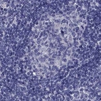 Immunohistochemical staining of human lymph node using Anti-STAR antibody HPA023644.