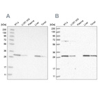 Anti-PROSC Antibody