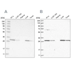 Western blot analysis using Anti-PROSC antibody HPA023646 (A) shows similar pattern to independent antibody HPA023733 (B).