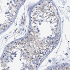 Anti-PROCA1 Antibody