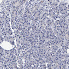 Anti-PROCA1 Antibody