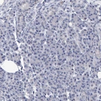 Immunohistochemical staining of human pancreas shows no positivity in exocrine glandular cells as expected.