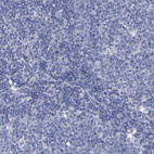 Anti-PROCA1 Antibody