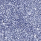 Immunohistochemical staining of human tonsil shows no positivity in germinal center cells as expected.