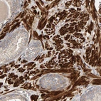 Immunohistochemical staining of human prostate shows strong cytoplasmic positivity in smooth muscle cells.