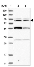 Lane 1: Marker [kDa] 230, 130, 95, 72, 56, 36, 28, 17, 11_br/_Lane 2: Human cell line RT-4_br/_Lane 3: Human cell line U-251MG sp
