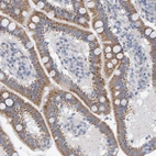 Anti-ZC3H3 Antibody
