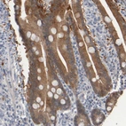 Anti-EPHX2 Antibody