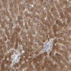 Immunohistochemical staining of human liver shows moderate to strong cytoplasmic positivity in hepatocytes.