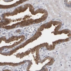Immunohistochemical staining of human prostate shows strong cytoplasmic positivity in glandular cells.