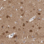Immunohistochemical staining of human Cerebral cortex shows strong cytoplasmic positivity in neuronal cells.