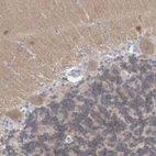 Immunohistochemical staining of human Cerebellum shows moderate cytoplasmic positivity in Purkinje cells.