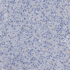 Anti-NCDN Antibody