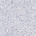 Immunohistochemical staining of human Liver shows no cytoplasmic positivity in hepatocytes as expected.