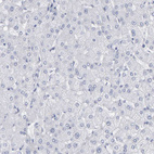 Anti-NCDN Antibody