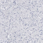 Immunohistochemical staining of human Liver shows no cytoplasmic positivity in hepatocytes as expected.