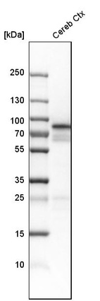 Anti-NCDN Antibody